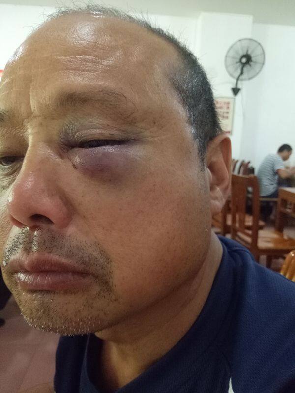 宁顺花父亲被陈定华打伤