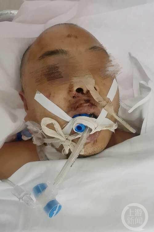 寻亲男孩刘学州舅舅打工时六楼坠落 舅妈：伤好后继续追踪外甥案件进展
